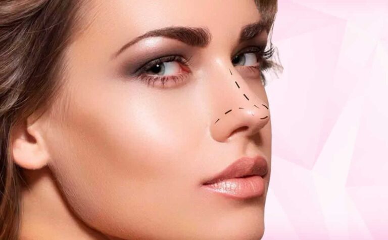 Leia mais sobre o artigo Rinoplastia – Cirurgia do nariz