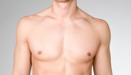 Ginecomastia – Redução de mama masculina