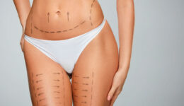 Cirurgia plástica pós-bariátrica: saiba quando fazer e quais são as recomendações médicas