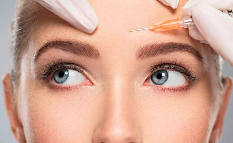 Leia mais sobre o artigo O que é um Tratamento de Botox (toxina botulínica)