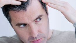 Calvície (Alopecia, Queda de Cabelo)